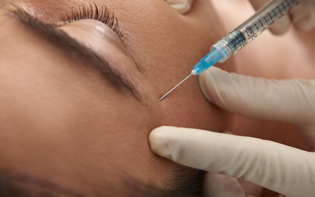 Rughe di Espressione: come eliminarle con il Botox